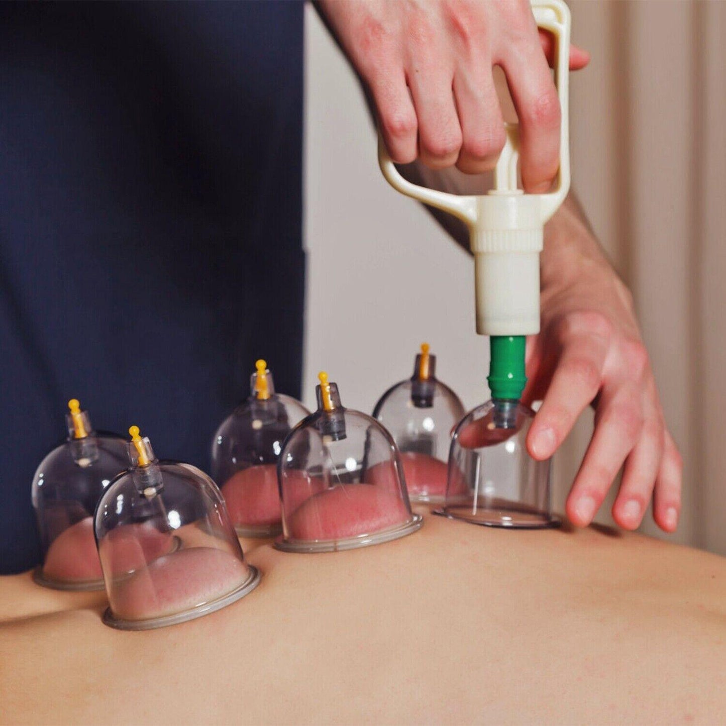 Cupping Therapy Set - 32PCS Cupping Vacuum Massage Cups Set Therapy Health Acupuncture Suction Magnet