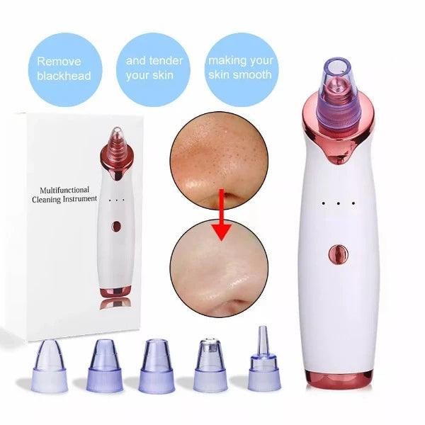 Best Blackhead Remover Vacuum - Professional Pore Cleaner Vacuum Blackhead Remover Rechargeable 5 Suction Levels