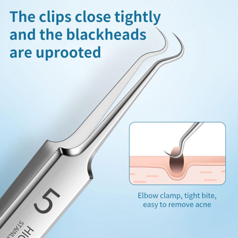 Blackhead Remover Needle - Acne Needle Kit Blackhead Remover Pimple Blemish Comedone Extractor Tweezer Tool