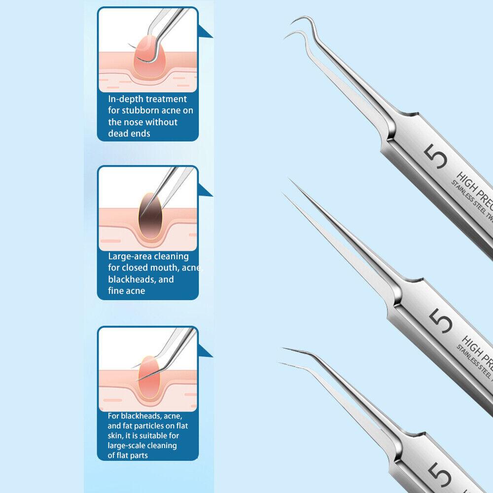 Blackhead Remover Needle - Acne Needle Kit Blackhead Remover Pimple Blemish Comedone Extractor Tweezer Tool