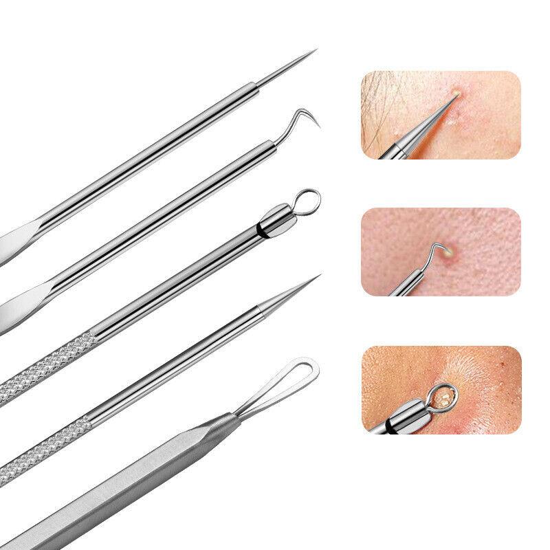 Blackhead Remover Needle - Acne Needle Kit Blackhead Remover Pimple Blemish Comedone Extractor Tweezer Tool