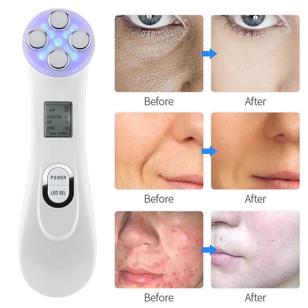 Face Tightener Machine - 5 in1 LED RF Skin Beauty Instrument Ultrasonic Face Massager Anti-aging Device