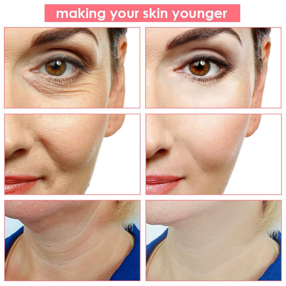 Face Tightener Machine - 5 in1 LED RF Skin Beauty Instrument Ultrasonic Face Massager Anti-aging Device