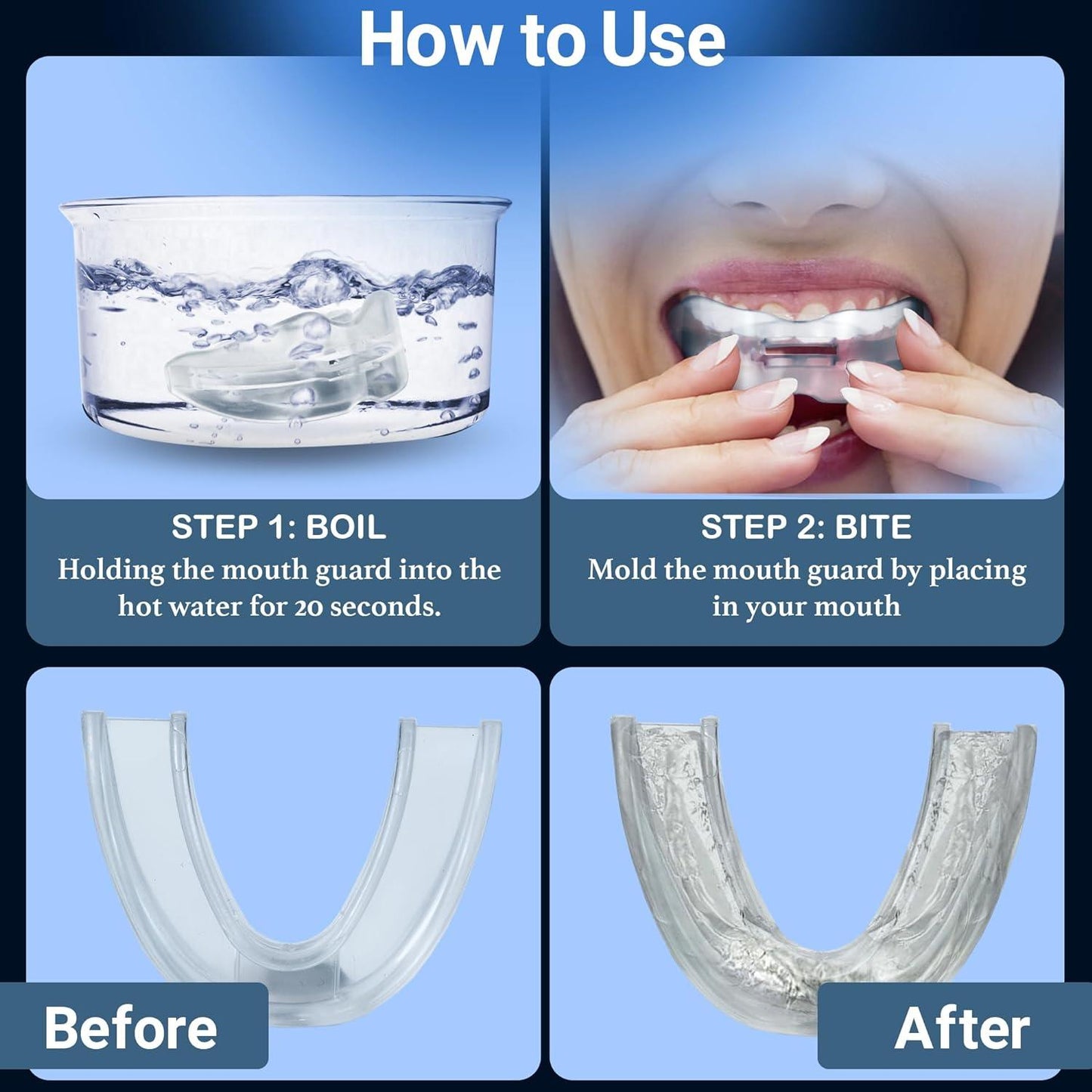 Mouthguard for Snoring - NHS Snore Stopper Anti Snoring Mouth Guard Device Sleep Aid Stop Apnoea