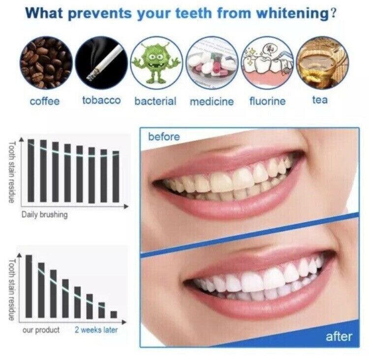 Teeth Whitening Strips - 28 Professional Advanced Teeth Whitening Strips Home Tooth Bleaching Non-Toxic Sensitivity Free