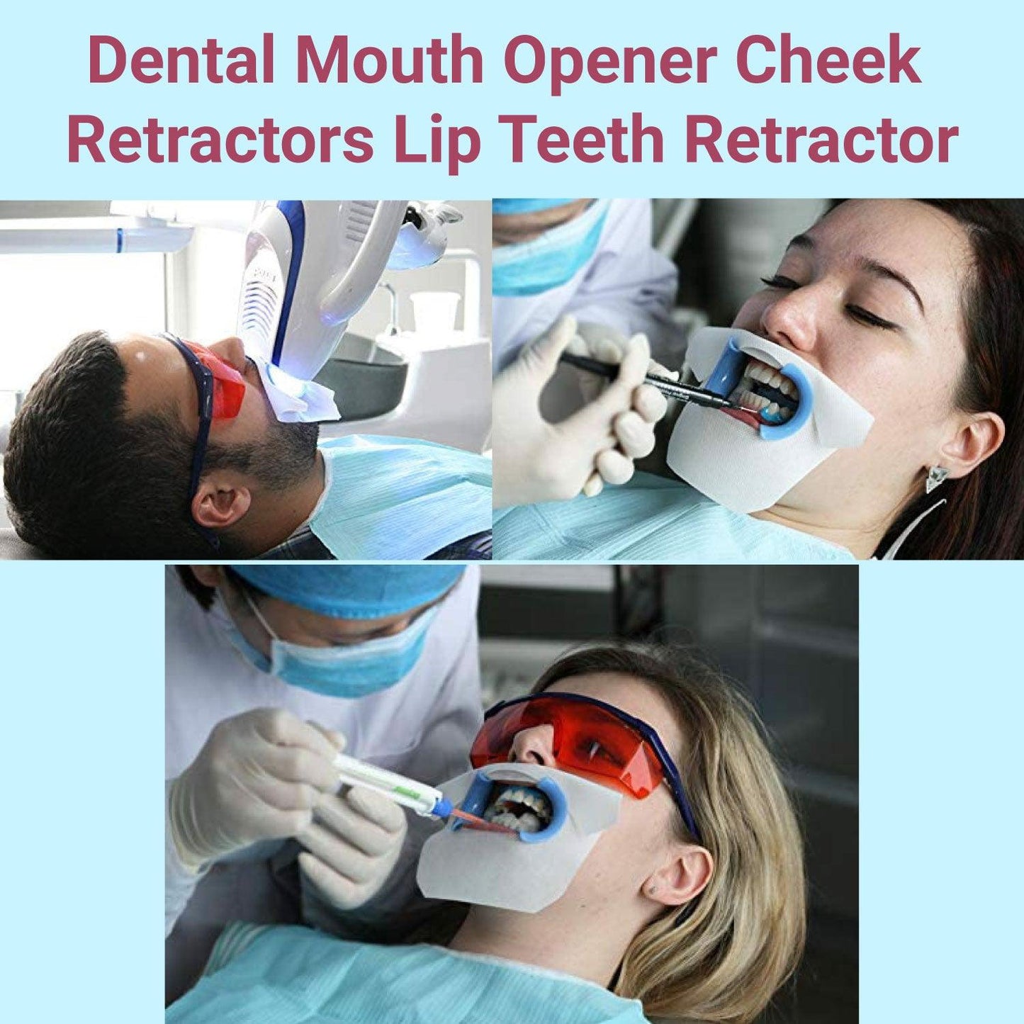 Cheek Retractors Dental - Mouth Opener 10pcs M Shape Blue Cheek Retractor Dental Mouth Opener Orthodontic Mouth Prop Opener Dental Treatment Kit