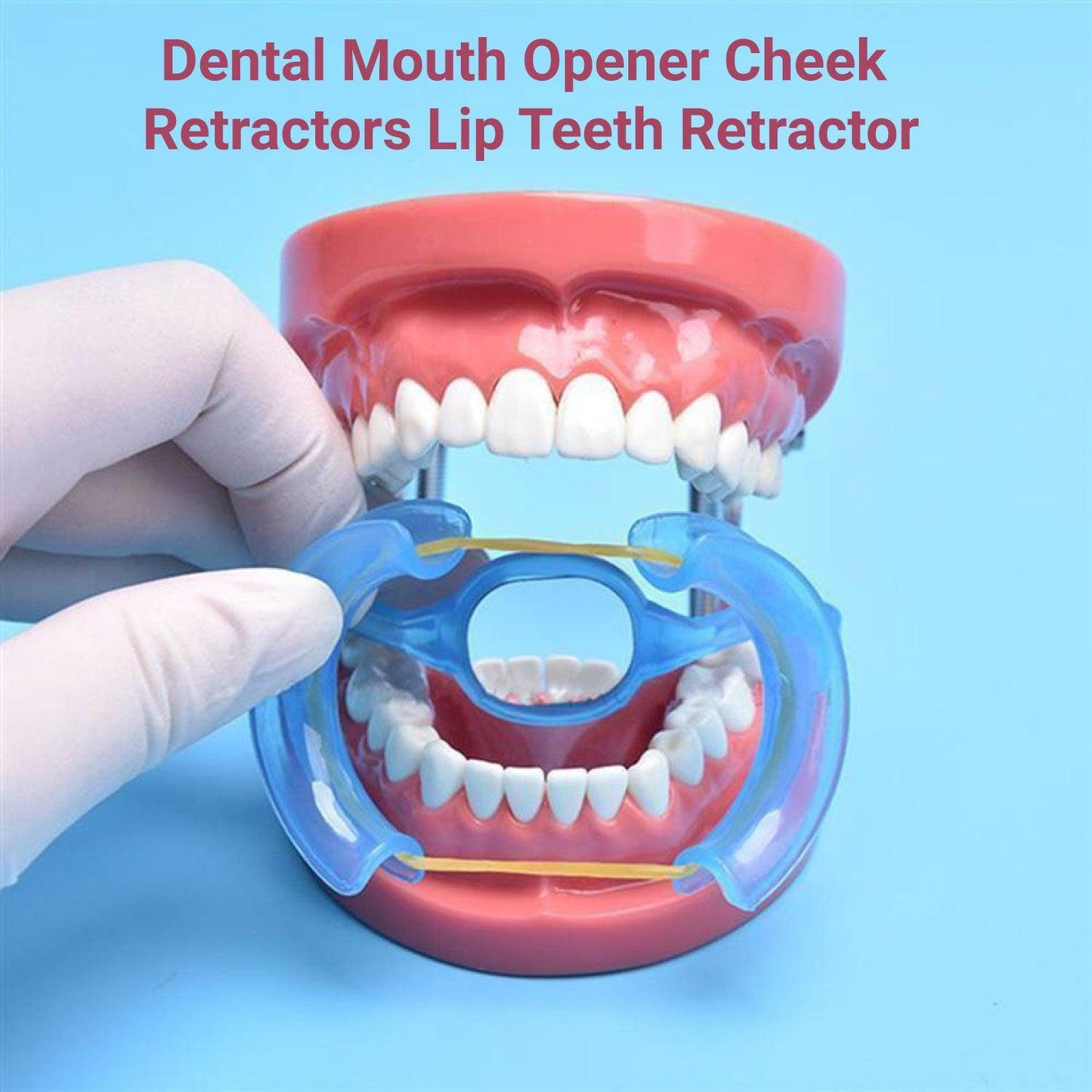 Cheek Retractors Dental - Mouth Opener 10pcs M Shape Blue Cheek Retractor Dental Mouth Opener Orthodontic Mouth Prop Opener Dental Treatment Kit