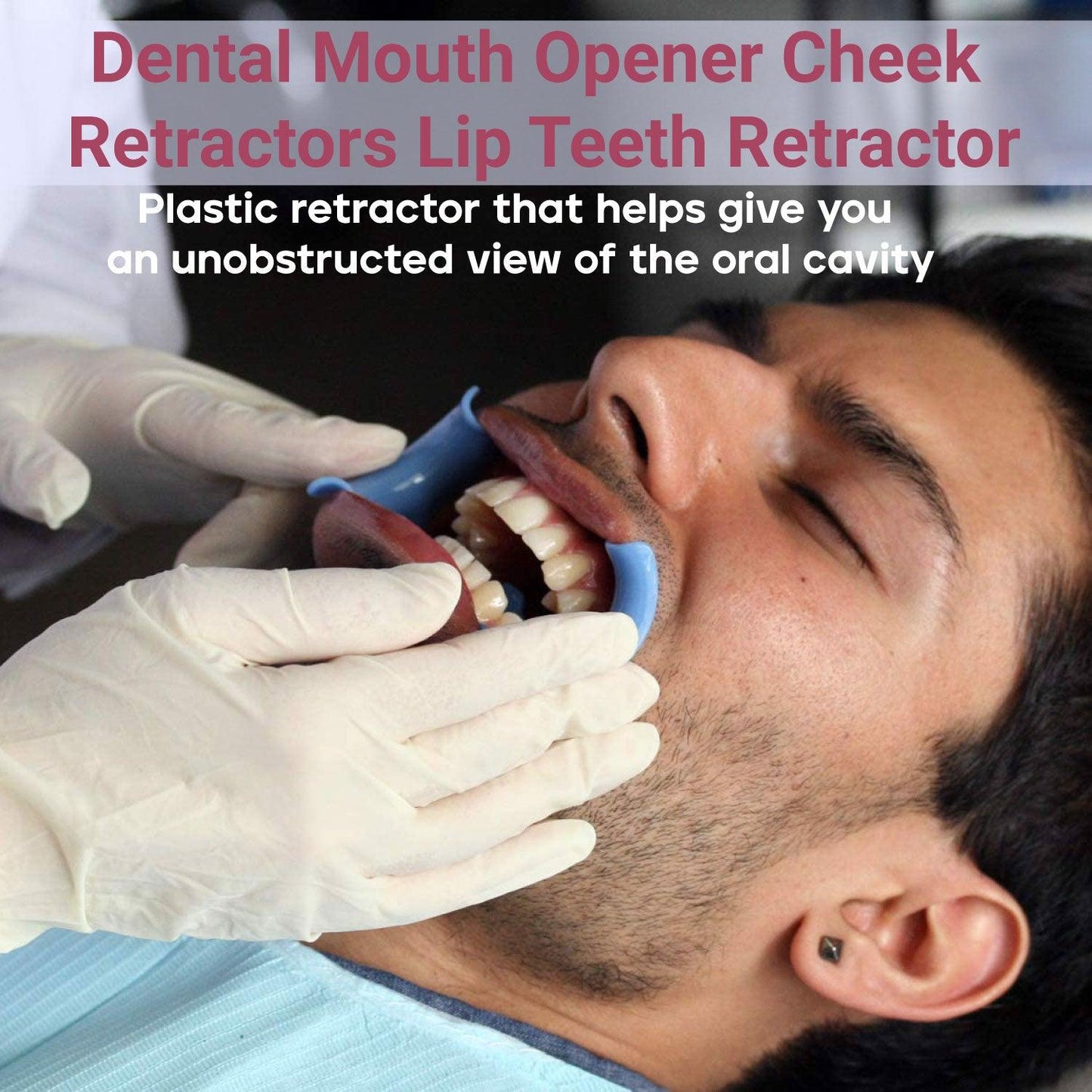 Cheek Retractors Dental - Mouth Opener 10pcs M Shape Blue Cheek Retractor Dental Mouth Opener Orthodontic Mouth Prop Opener Dental Treatment Kit