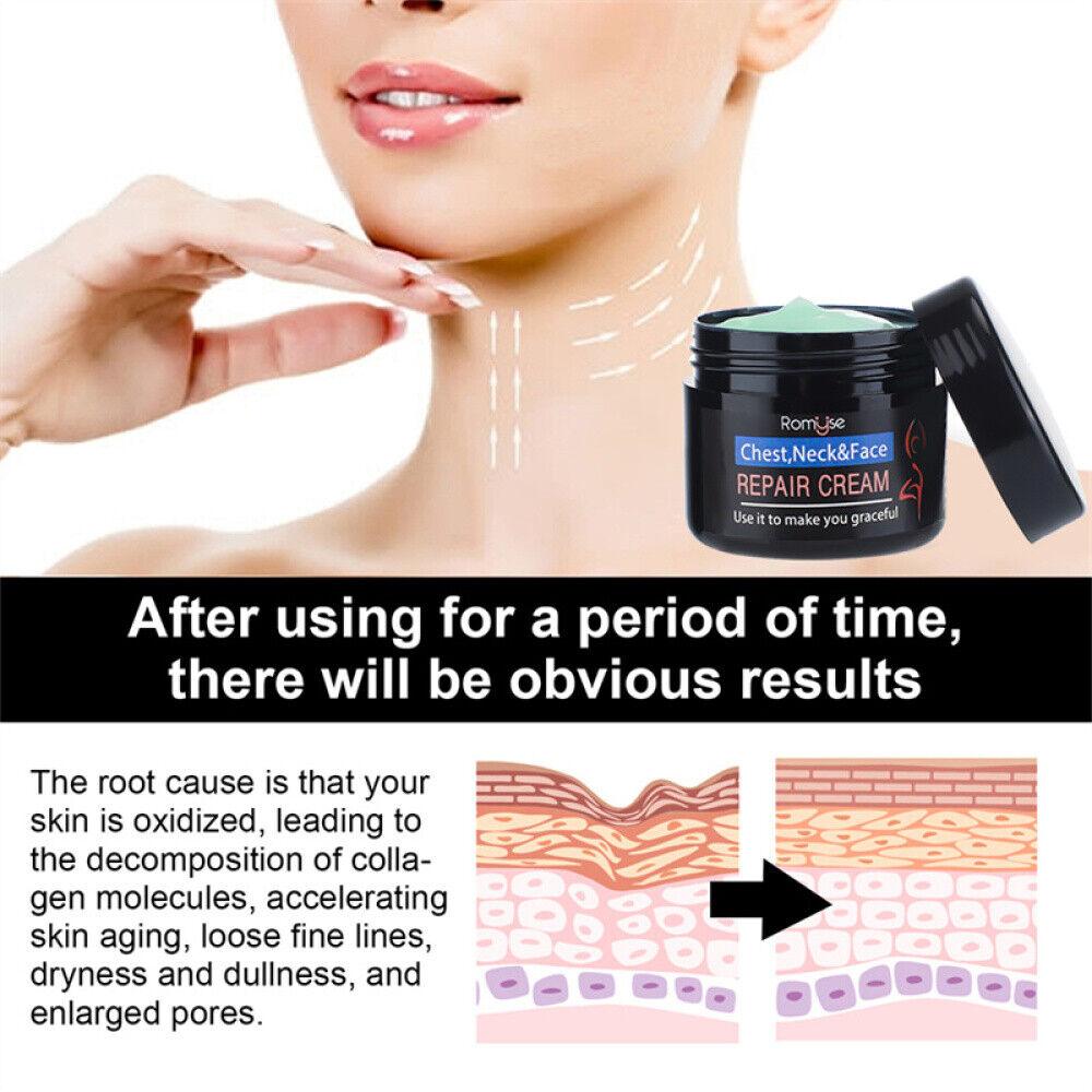 Cream for Wrinkles Neck - V Shaping Massager Electric Slim LIFT Double Chin Removal device