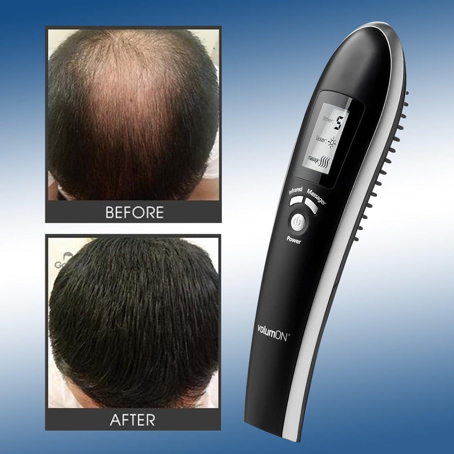 Laser Combs for Hair Growth - Laser Massage Comb For Infrared Hair Growth Regrowth Hair Thickening Home Use UK