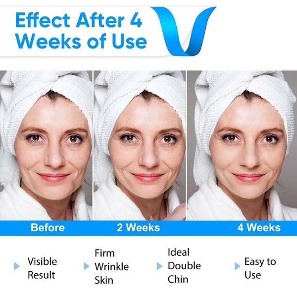 Double Chin Massager - Electric V-Face Shaping Massage Face Lifting Slim Double Chin Removal Machine