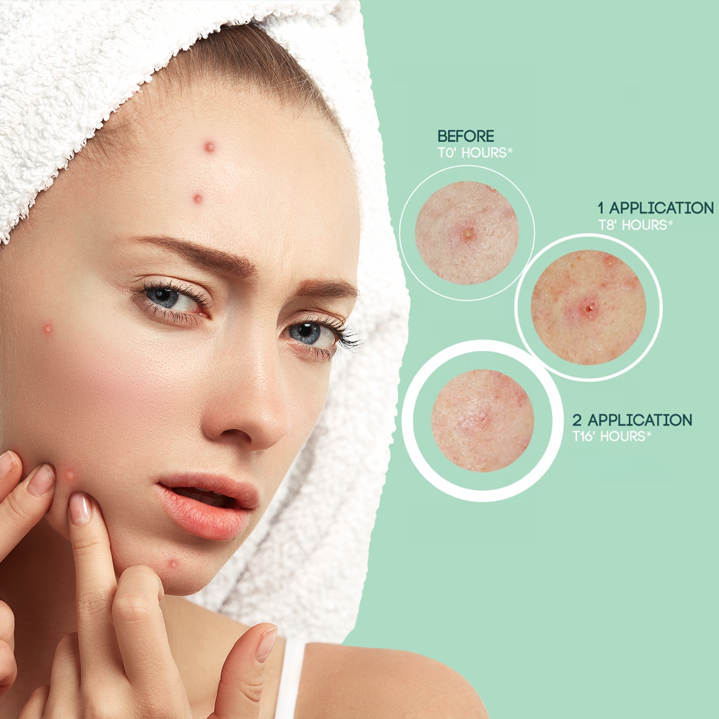 Hydrocolloid Pimple Patches – Dots for Spots Acne Patch | Pack of 24 Korean Skincare Spot Stickers