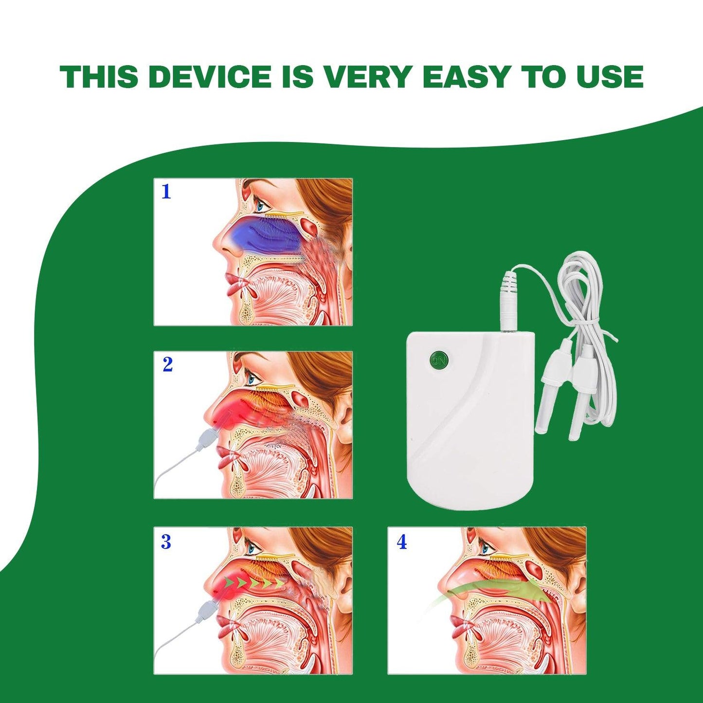 Infrared Allergy Reliever - Nose Rhinitis Therapy Device Sinusitis Cure Treatment Hay Fever Relief Allergy