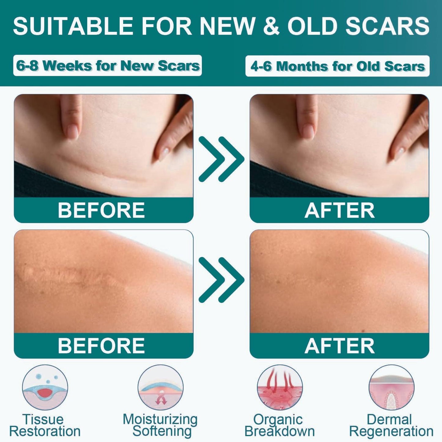 Silicone Scar Sheets - Medical Grade (1.6"x120") Scar Tape Professional Reusable Scar Removal Treatment