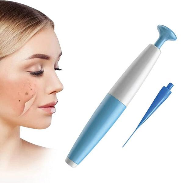 Skin Tag Removal Kit - Natural Painless Auto SKIN TAG Removal Skin tag bands Remover Device