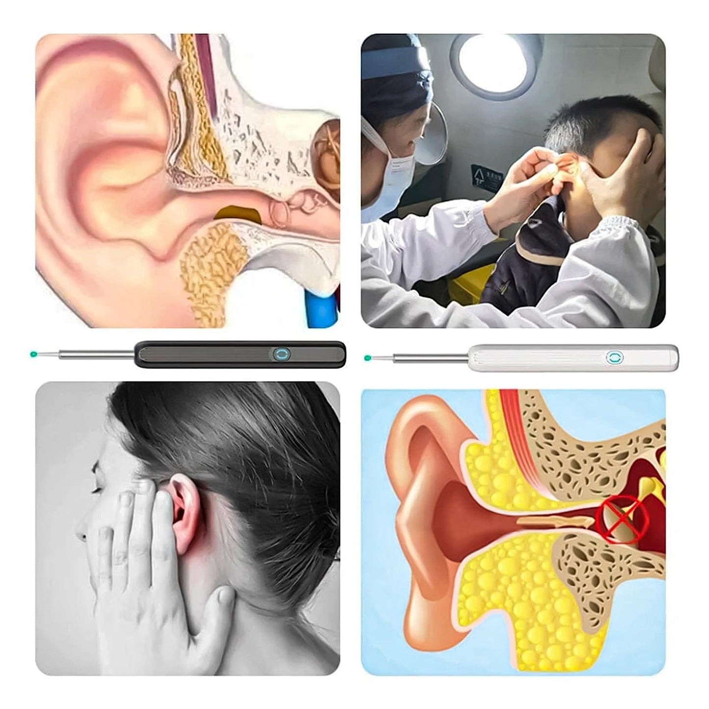 Ear Cleaning Machines - Wi -Fi visible wax elimination spoon
