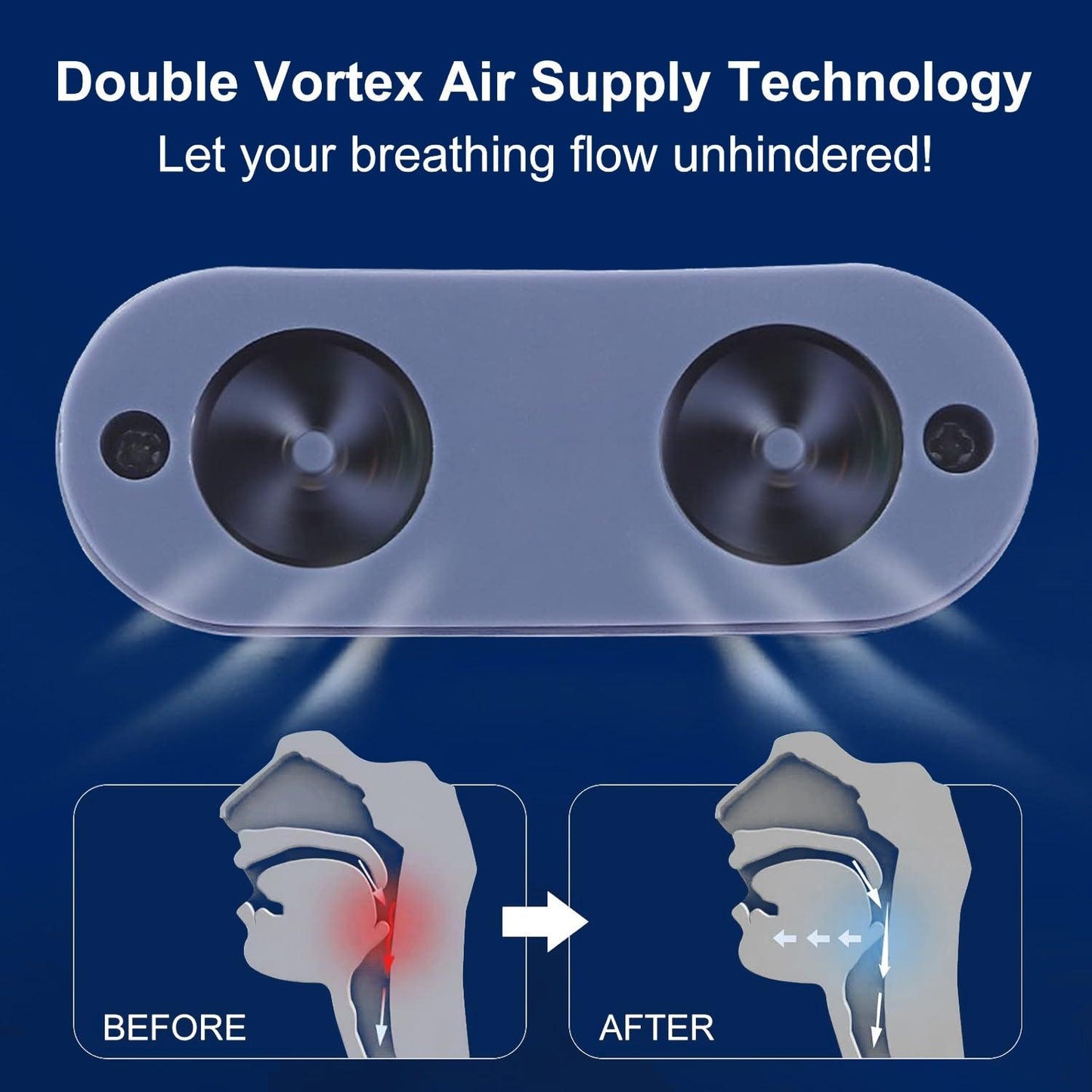 Sleep Apnea Device - Stop Snore Micro Anti Snoring Device Electric Noise Stopper