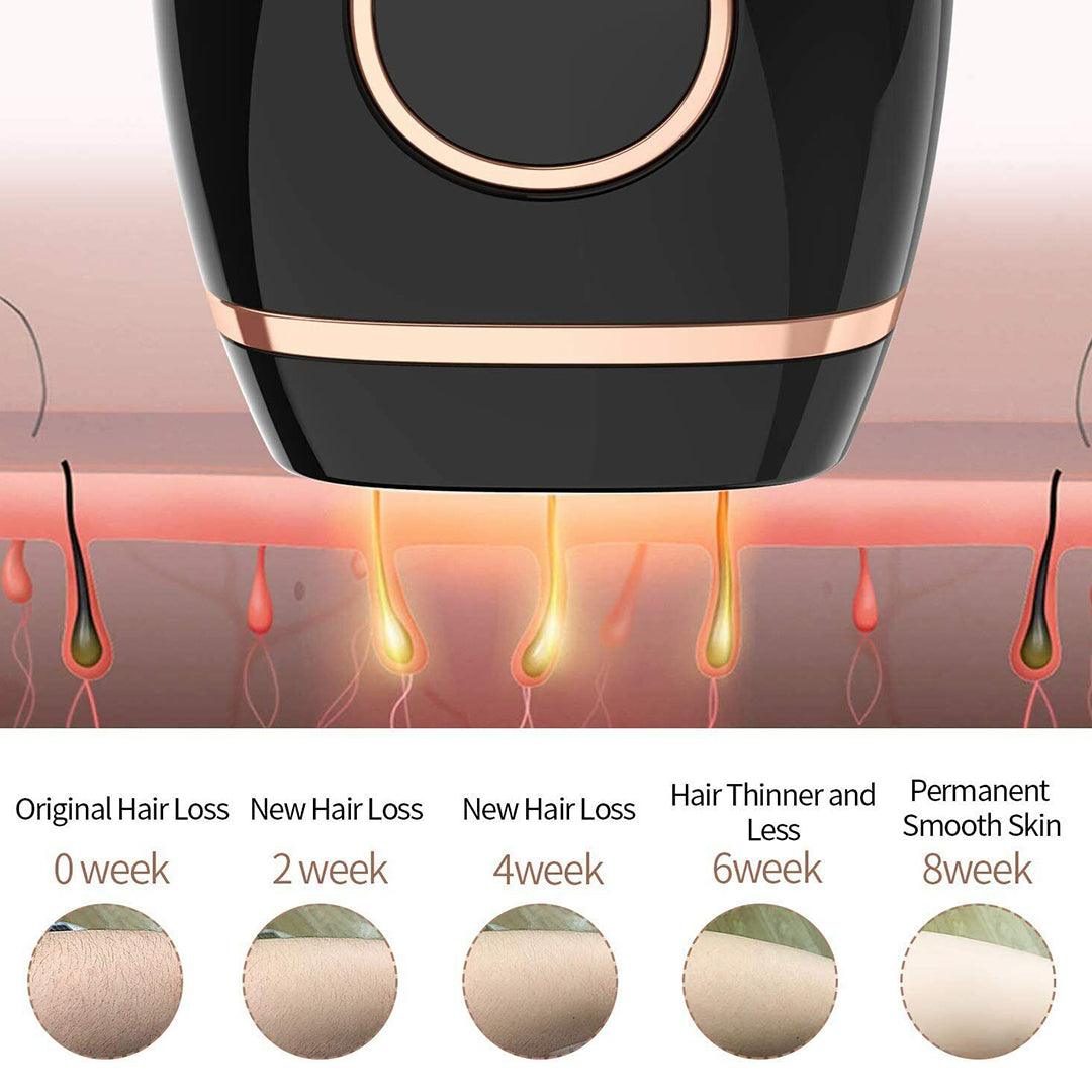 Home Hair Removal Laser - Laser Hair Removal Machine Permanent Painless Epilator Body Facial