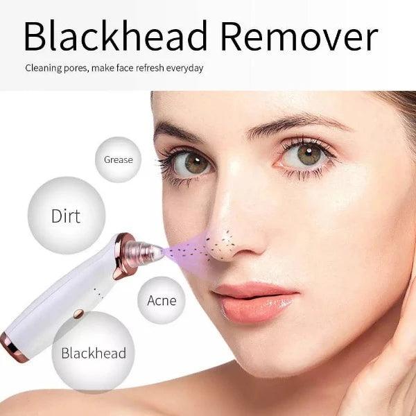 Best Blackhead Remover Vacuum - Professional Pore Cleaner Vacuum Blackhead Remover Rechargeable 5 Suction Levels