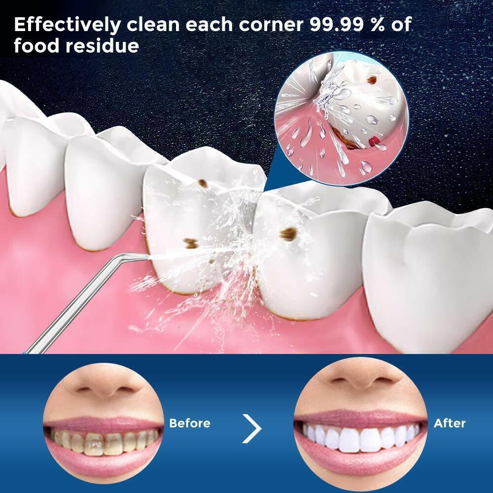 Waterpik Cordless Water Flosser - Cordless Water Flosser Dental Oral Irrigator for Teeth Cleaner 8 Jet Tips