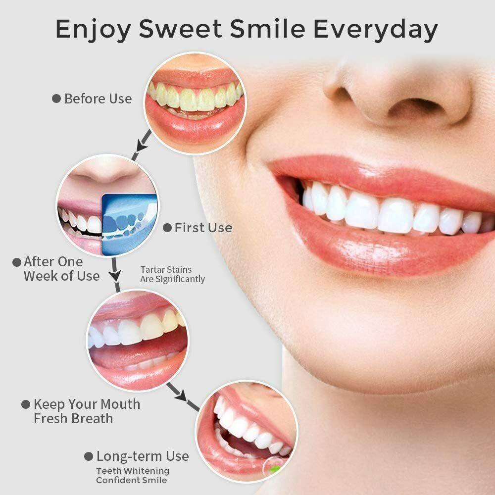 Waterpik Cordless Water Flosser - Cordless Water Flosser Dental Oral Irrigator for Teeth Cleaner 8 Jet Tips