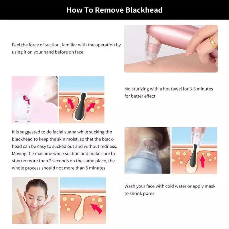 Best Blackhead Remover Vacuum - Professional Pore Cleaner Vacuum Blackhead Remover Rechargeable 5 Suction Levels