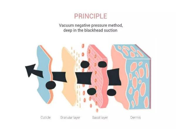 Best Blackhead Remover Vacuum - Professional Pore Cleaner Vacuum Blackhead Remover Rechargeable 5 Suction Levels