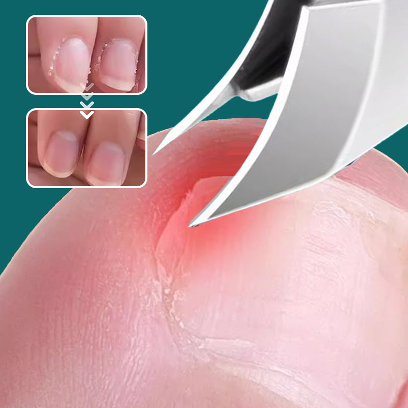 Anti-Splash Slant Edge Nail Clipper 3-Piece Set