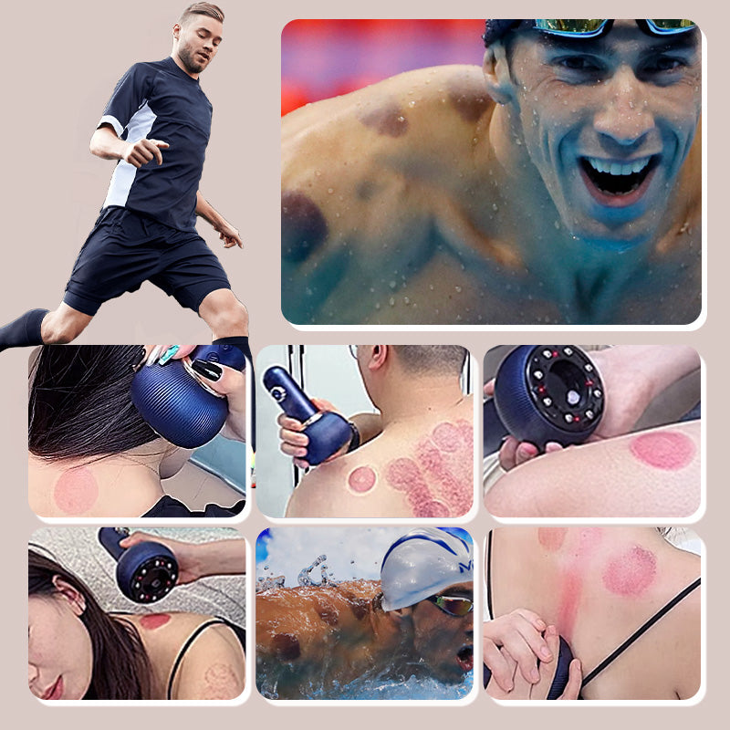 Electric Cupping Therapy Massager & Meridian Brush Set